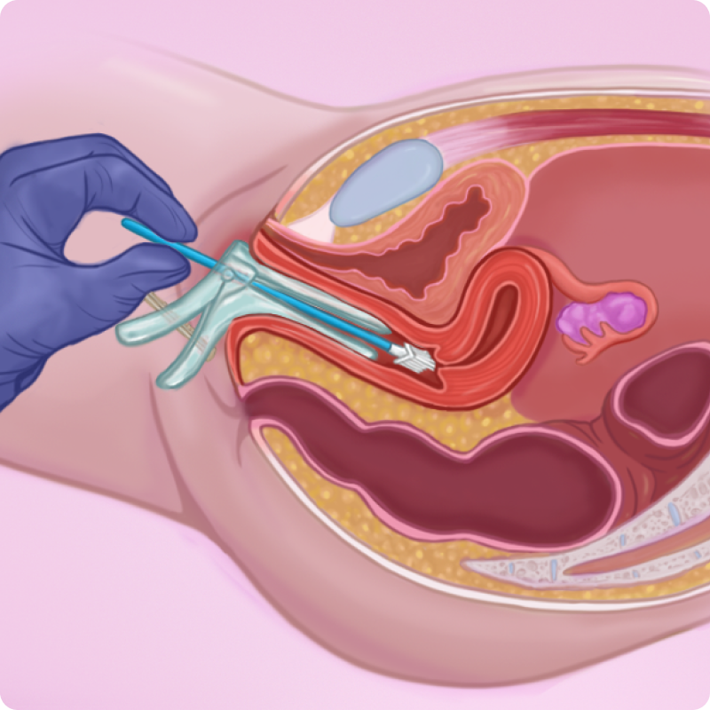 Cervix