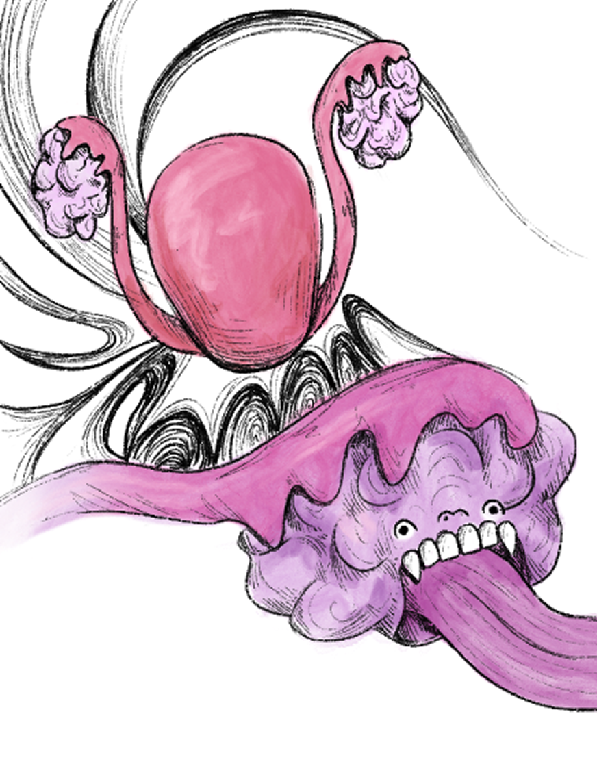 WIP1